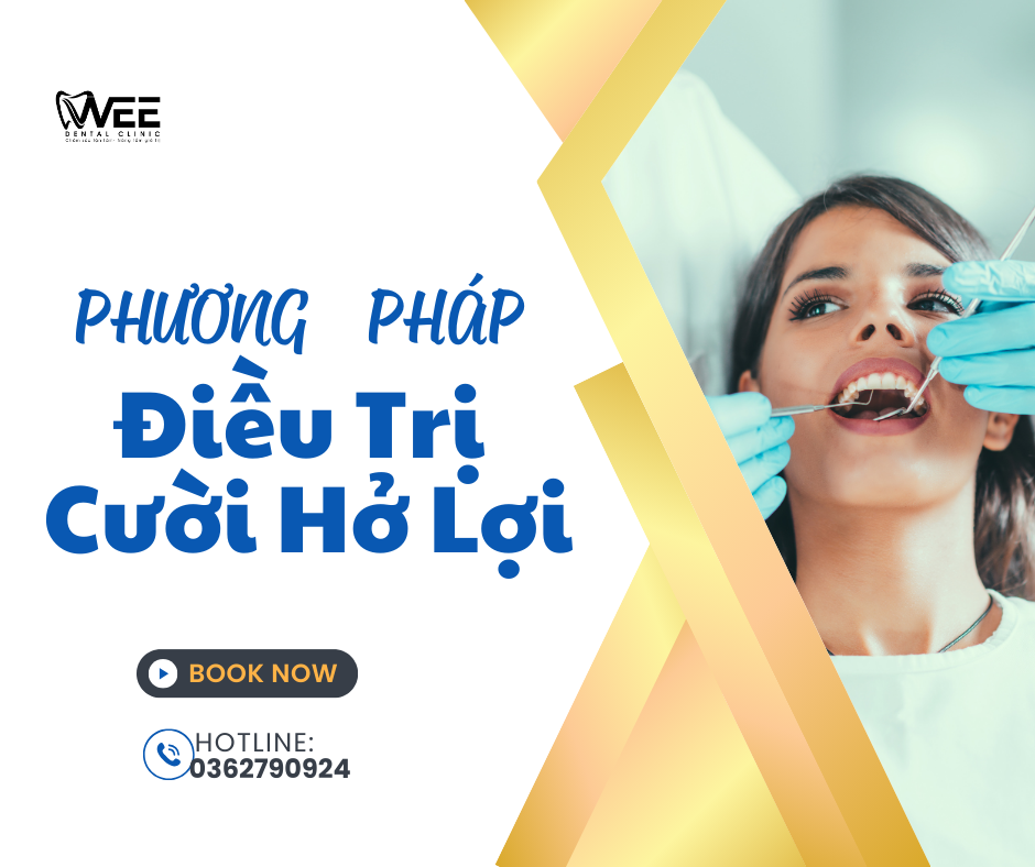 Cười hở lợi, nụ cười