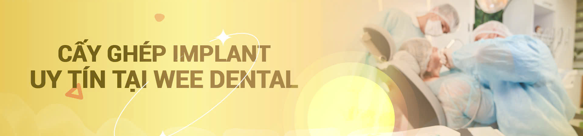 IMPLANT
