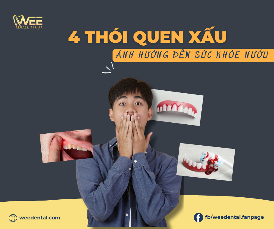 Nướu răng