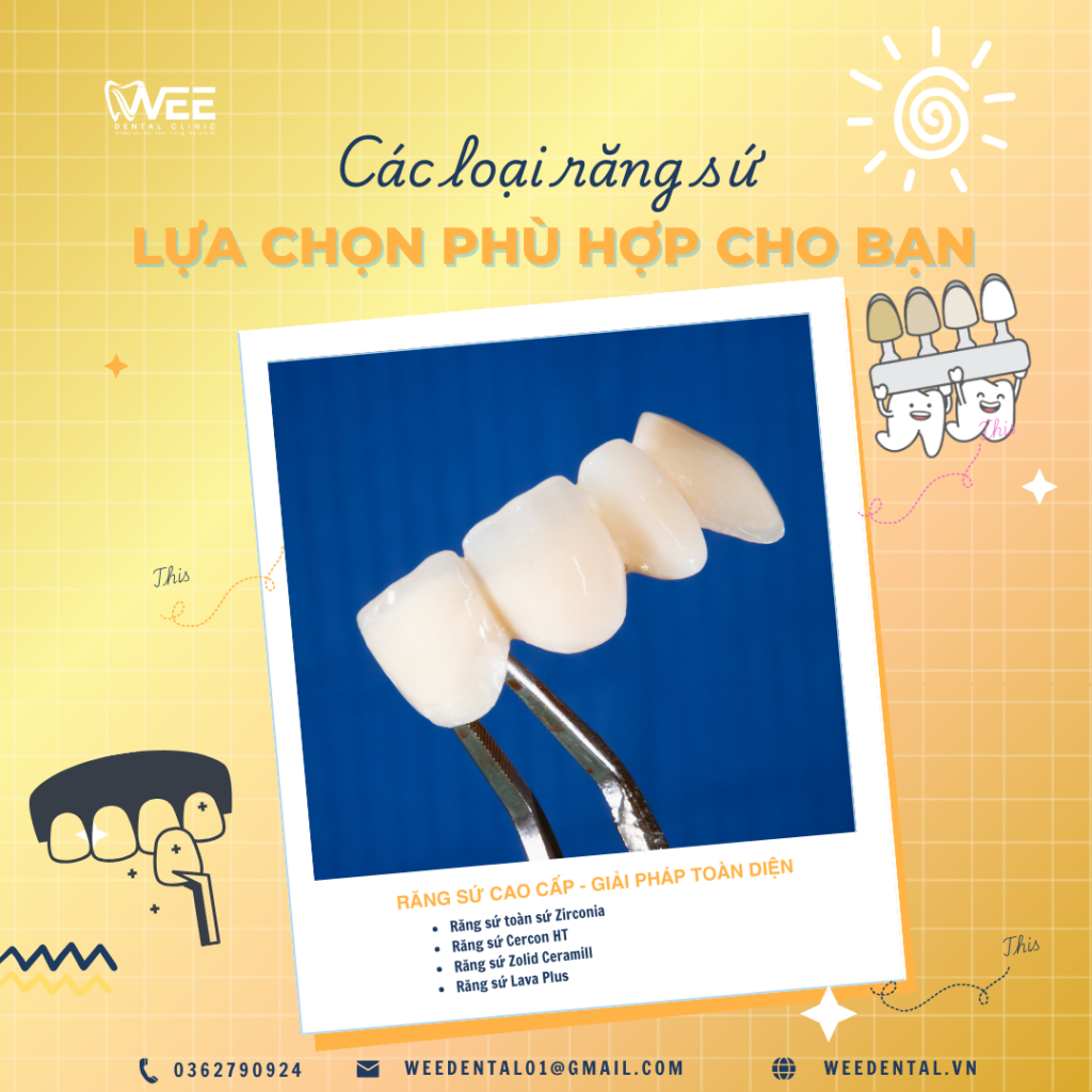 Răng Sứ Thẩm Mỹ