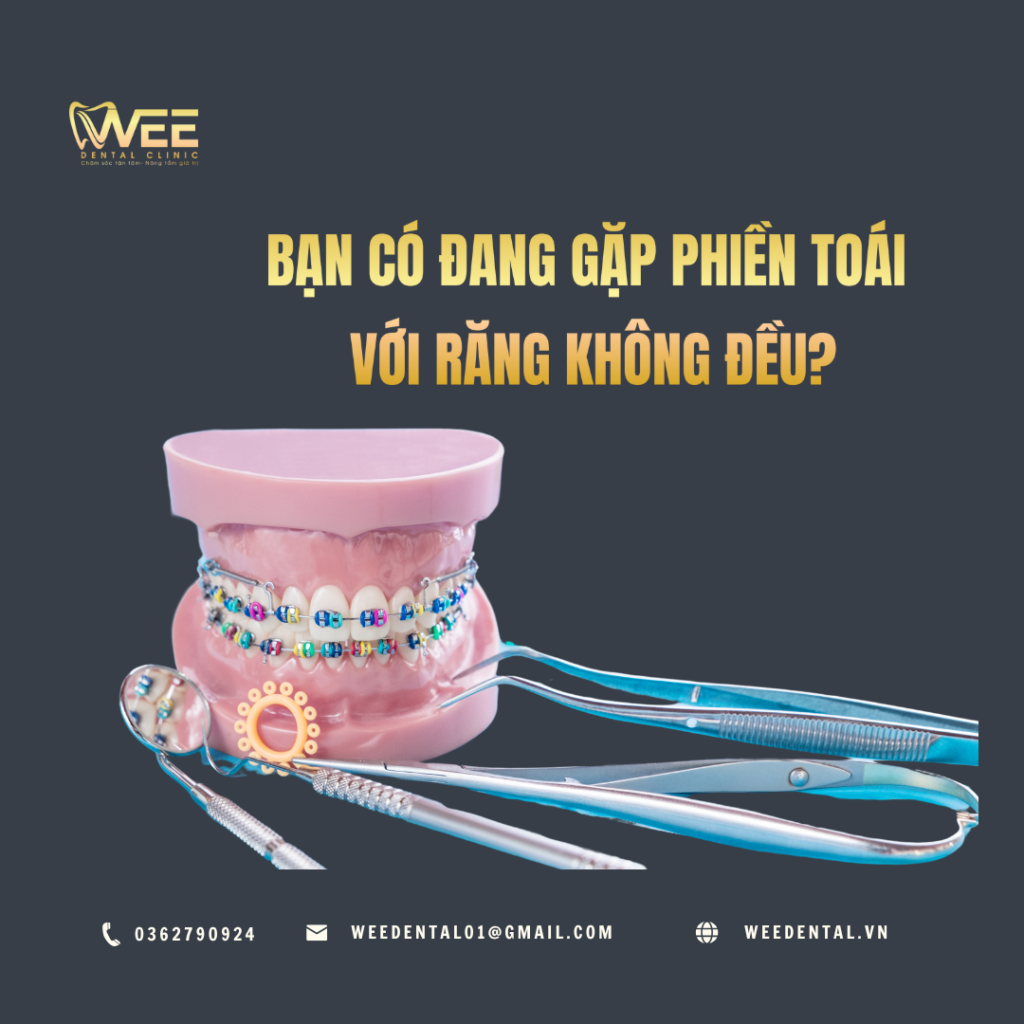 chỉnh nha