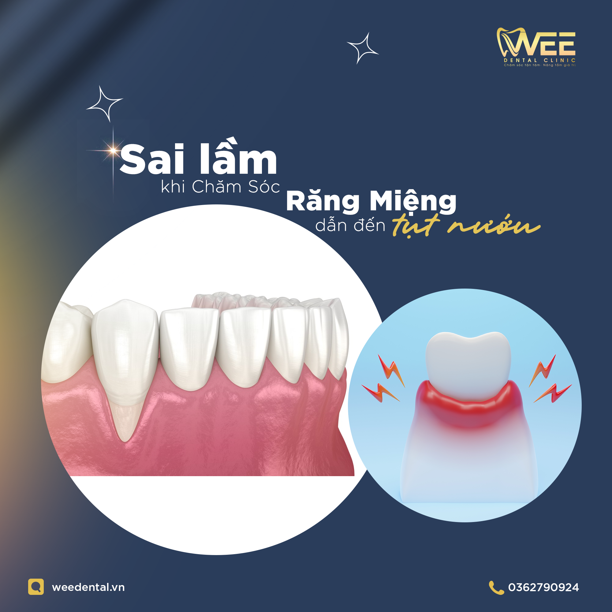 TỤT NƯỚU
