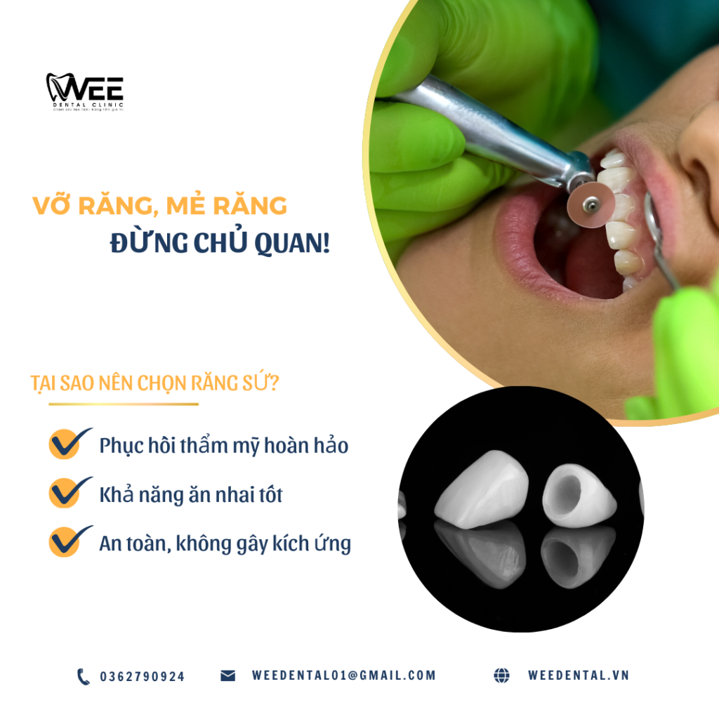 RĂNG SỨ