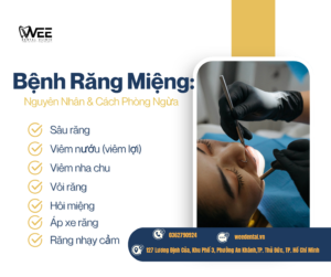 Bệnh răng miệng