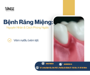 Bệnh răng miệng