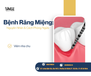 Bệnh răng miệng