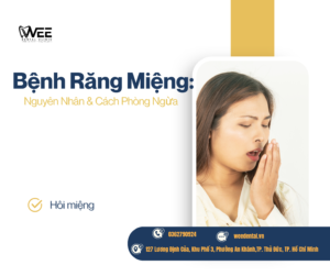 Bệnh răng miệng