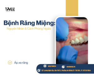 Bệnh răng miệng