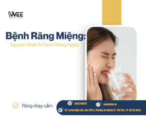 Bệnh răng miệng