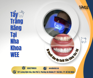 Tẩy trắng răng