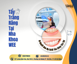 Tẩy trắng răng
