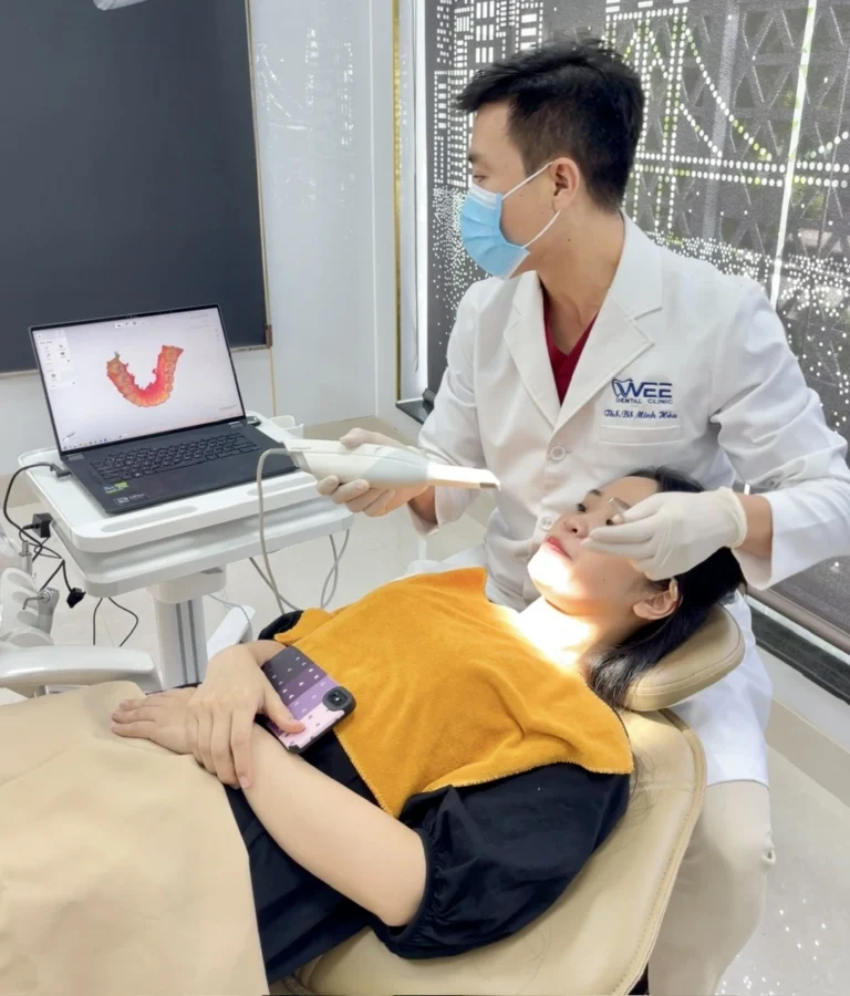 niềng răng giá bao nhiêu