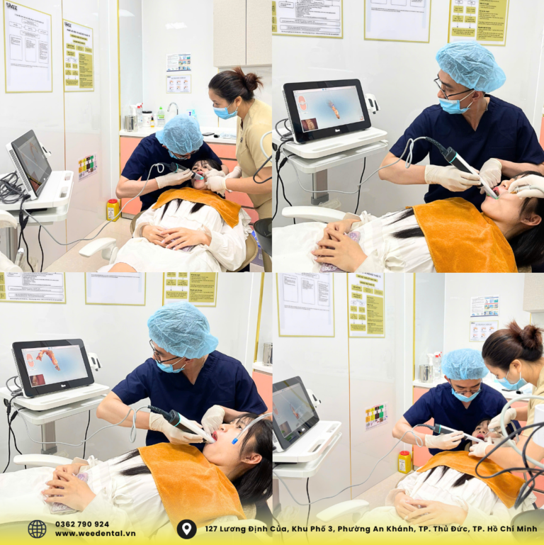 máy scan 3D trong lấy dấu răng