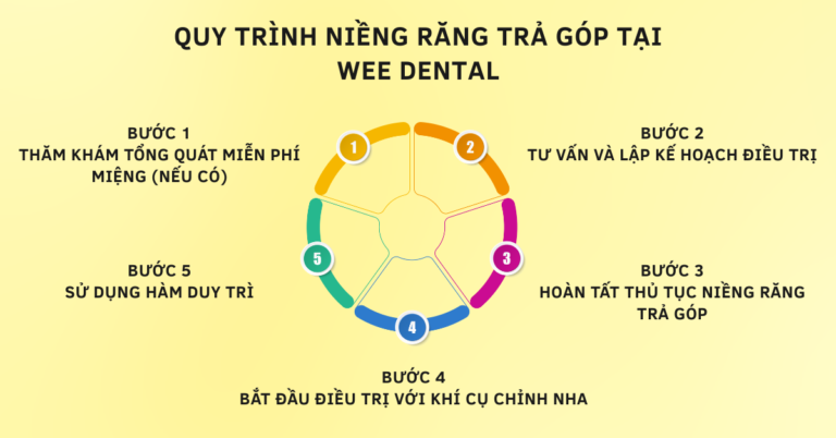 thủ tục niềng răng trả góp