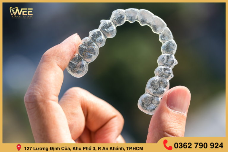 khay niềng răng trong suốt Invisalign