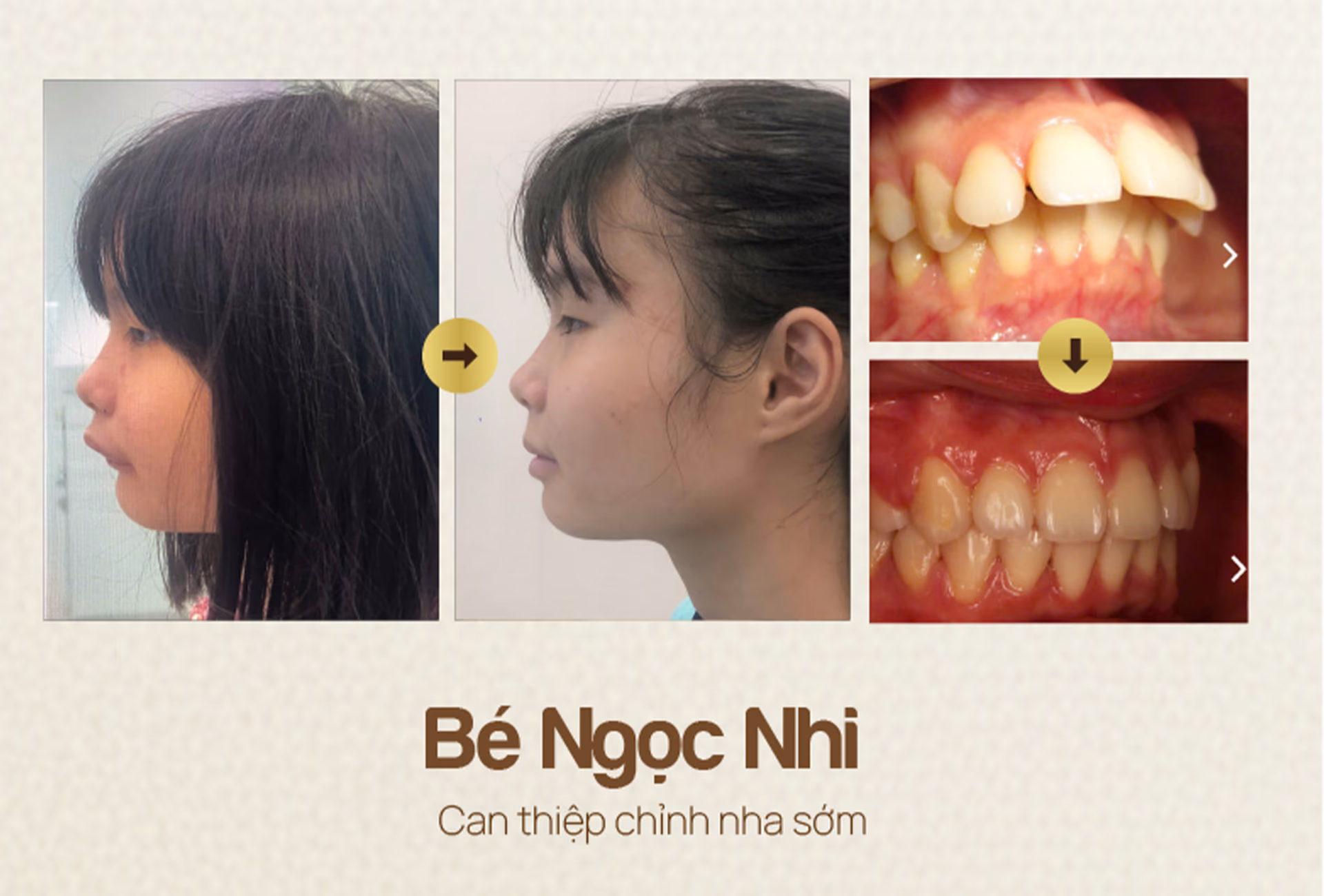 nha-khoa-wee-dieu-tri-truoc-va-sau