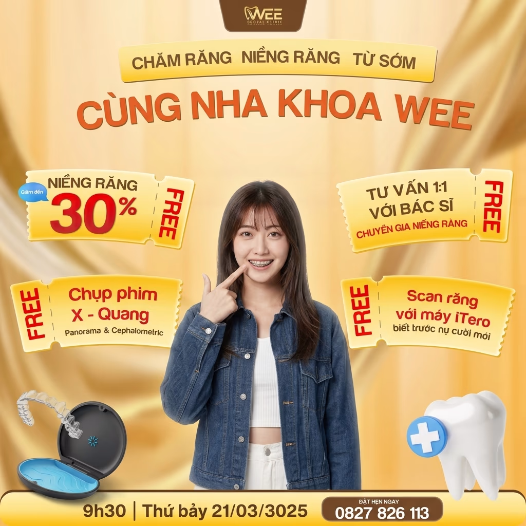 ngày hội niềng răng